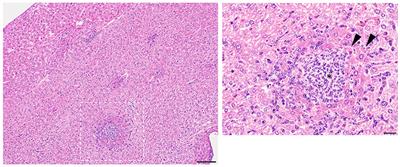 Differing Virulence of Healthy Skin Commensals in Mouse Models of Infection